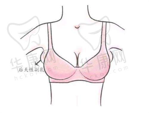 沈阳杏林整形医院热门项目双眼皮有什么特点？