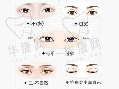 武汉徐国建隆胸范例有哪些亮点？