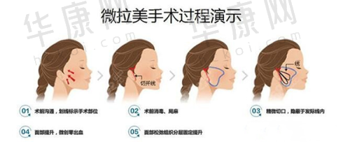 深圳今喜医疗美容门诊部曹孟君医生特色技术优势