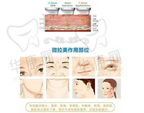 杨晓院长擅长哪些植发项目？