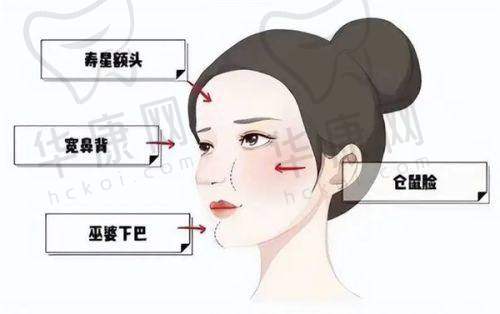 上海小创口修复“自然派”徐晓斐医生优势在哪？