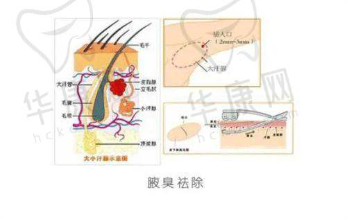 艺星整形美容医院电话预约常见问题有哪些？