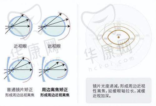 黑龙江哈尔滨云海眼科医院正规吗？