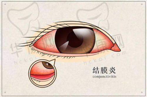 徐州爱尔眼科医院全飞秒手术之价格与服务