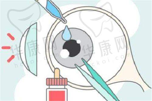 重庆合川爱成眼科医院ICL晶体植入手术的就诊便利性