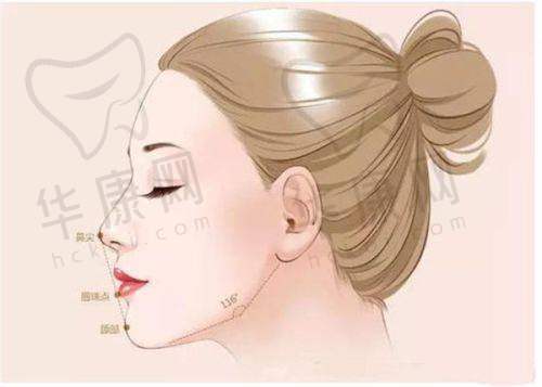 揭阳和美医疗美容张全镇拉皮之修复成效