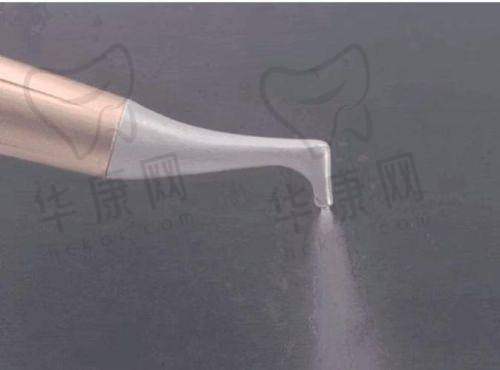 合肥泰康拜博口腔医院医生团队在喷砂洁牙上的优势