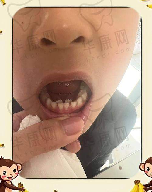 苏州英博口腔其他口腔项目价格及优势