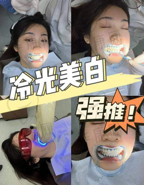 合肥泰康拜博口腔医院冷光美白644元起，性价比超高的牙齿美白之选！