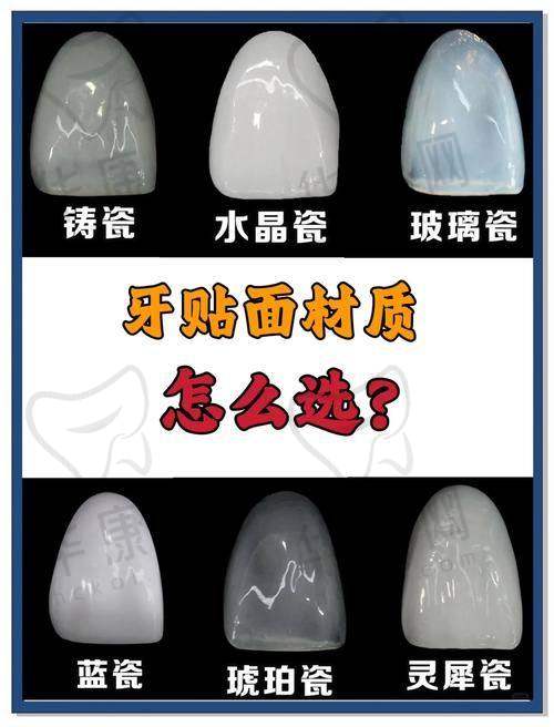 太原可睦口腔全口全瓷牙贴面服务优势