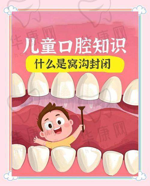 儿童窝沟封闭的其他注意事项