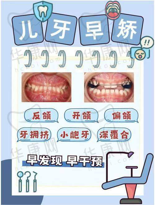 医生牛丽芳在儿童早期矫正方面的特色优势