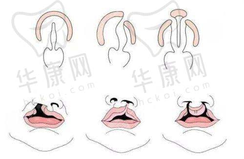 合肥隆鼻医生有哪些独特风格?