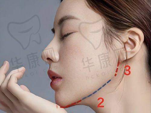 福田庆三怎么联系？如何预约手术？