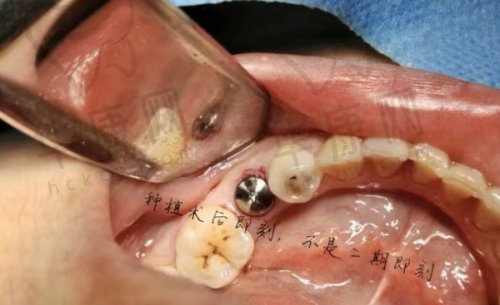 四、遂宁牙米口腔