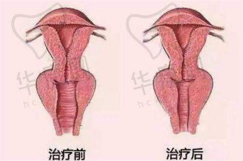 邓劲松医生在小眼综合项目上的特色优势
