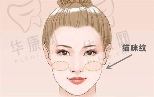 广州美莱富娜针剂注射30000元起，精细技艺雕琢自然持久的高阶美丽蜕变