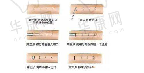 西安正规整形美容医院排名靠后的医院有何特色？