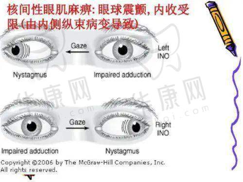 临汾洛基眼科医院泪囊炎治疗超给力，亲测从泪眼汪汪到明眸善睐太惊喜