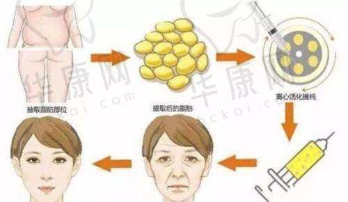 汕头雅靓悦美荟医疗美容康永培蜜桃丰胸的未来展望