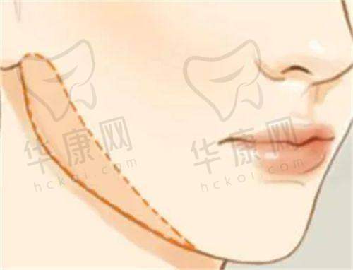 合肥去疤痕好的医院排名榜：壹加壹、艺星等各有何优势？哪家效果好？