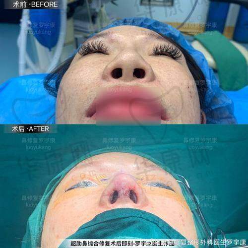 广州美莱医疗美容医院廖轶平鼻部整形的医院优势