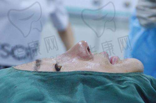 王天国医生做桃花鼻，技术优势体现在哪？