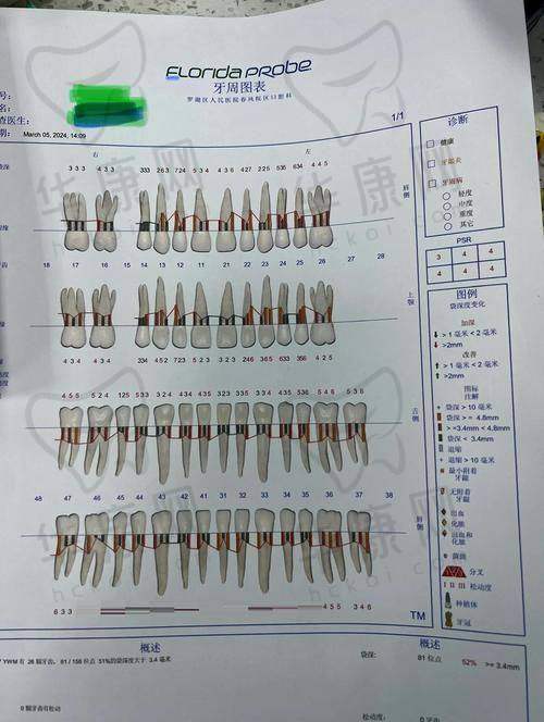 大同平城天使牙博士口腔龈下刮治208元起，高性价比口腔治疗之选！