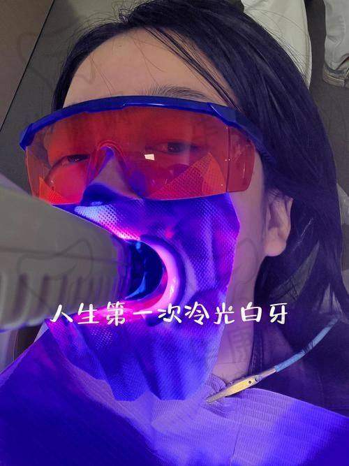 成都郫都鑫无忧口腔冷光美白与其他机构对比