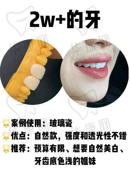 潍坊奎文华贝口腔义获嘉铸瓷贴面医院特色优势