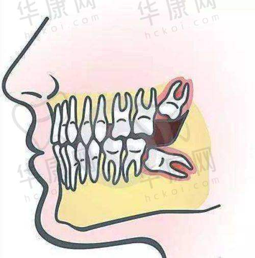 八、绵阳医博口腔门诊部特色项目介绍