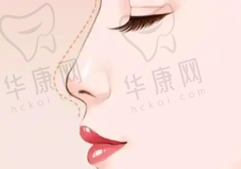 广州壹加壹整形美容医院翁超敏感肌修复治疗成效