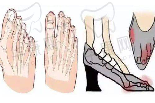 怀化美蒂珂医疗美容杨宁波腰腹吸脂之面诊体验