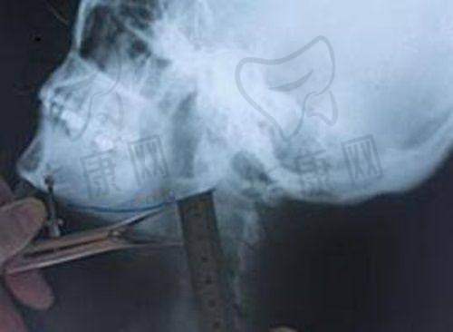 深圳鹏爱嘉琪医疗美容诊所怎么样？医院的详细介绍