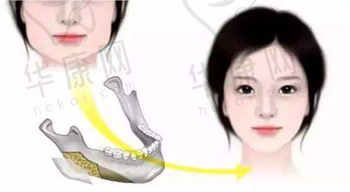 上海美莱医疗美容医院的服务与口碑情况