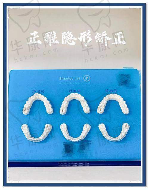 亲身体验宜昌爱合口腔医院柳祝说正雅隐形矫正，多种口腔问题迎刃而解