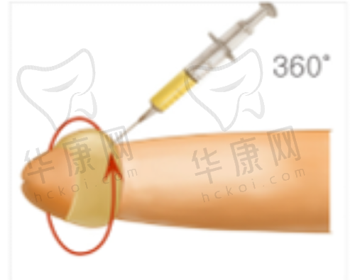 大连爱德丽格刘志刚双眼皮眼修复价格收费如何?透明合理!