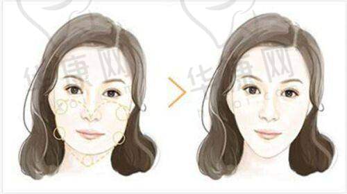 七、株洲爱思特整形医疗美容门诊部真实的患者评价如下: