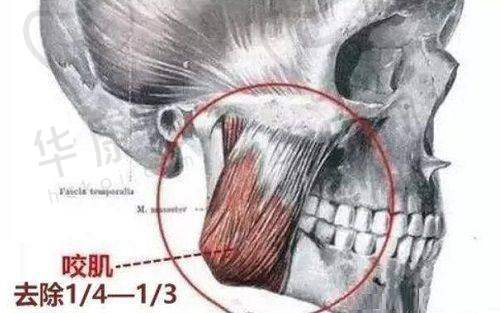 成都疤研疤痕医院正规靠谱吗？技术优口碑好成疤痕修复理想之选