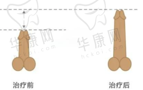 保定珍润医疗美容的技术口碑与实例