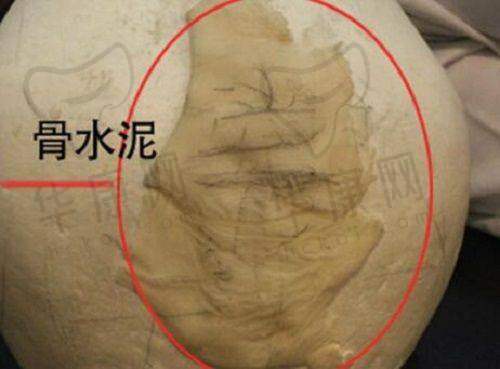 何明医生的口碑评价