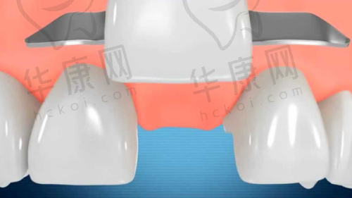 南京鼓楼各口腔医院价格表公布，含牙齿矫正、镶牙、拔智齿、补牙等项目费用