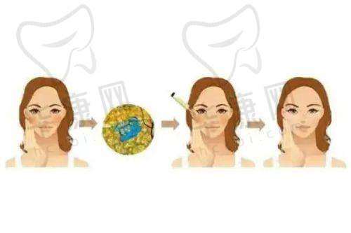 许昌辰星医疗美容门诊部预约挂号流程