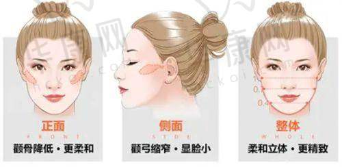 杭州禾慕时光医疗美容杨魏热望童颜针之初期成效显现
