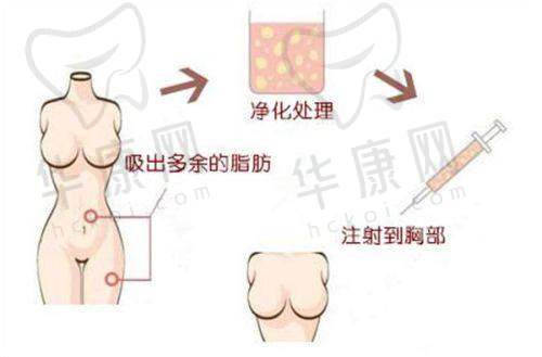 深圳非凡医疗美容医院是正规的吗?