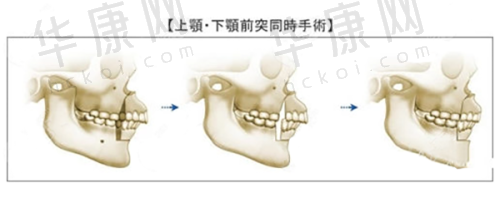 广州华美整形医院医师团队怎么样?擅长哪些项目?