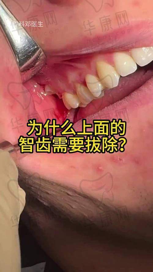 选择广元中舰口腔的建议与注意事项
