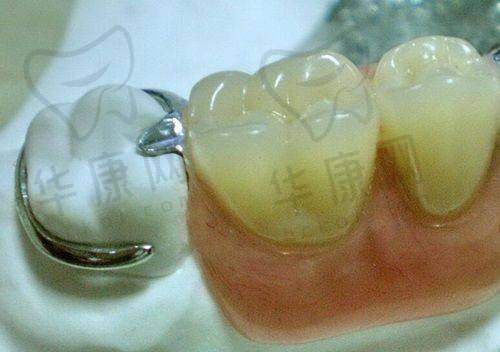 上海虹桥医院口腔科预约挂号流程：