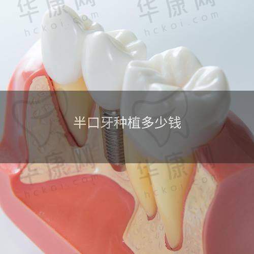内蒙呼和浩特天牙口腔祝昂明all-on-4半口种植之诊疗成效